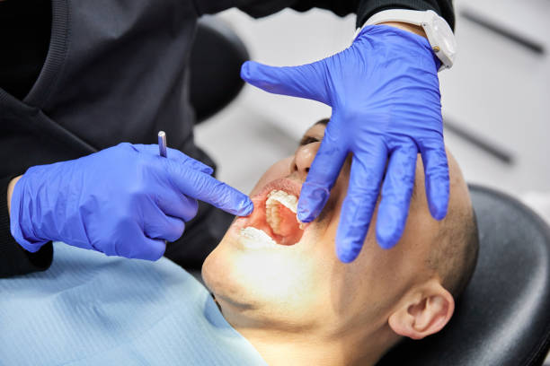 Best Emergency Treatment for Dental Infections or Abscesses in Wenonah, NJ