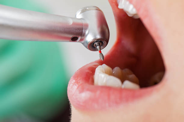Best Emergency Tooth Extraction in Wenonah, NJ